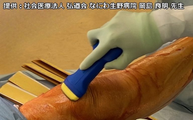 インテグシール　OV